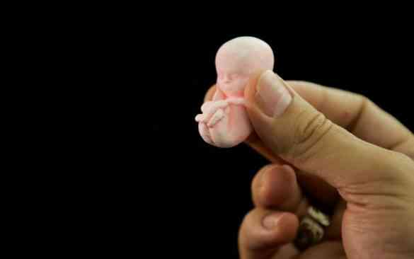 IN WHICH OF THESE CASES WOULD YOU RECOMMEND AN ABORTION?